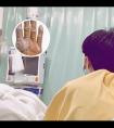如何选用308治疗仪器视频