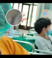 308准激光治疗白斑费用是多少