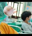 美国308用什么激光