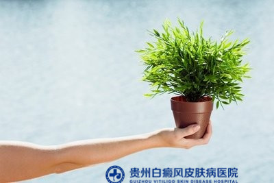 白癜风如何自查 白癜风如何自查