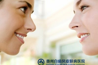 儿童白癜风怎么形成 儿童白癜风怎么形成