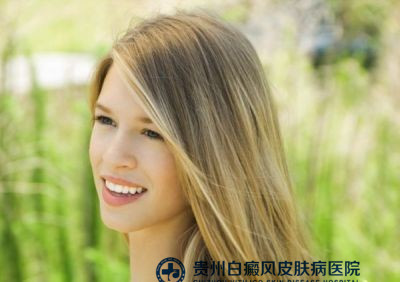 男性白癜风怎么治疗 男性白癜风怎么治疗