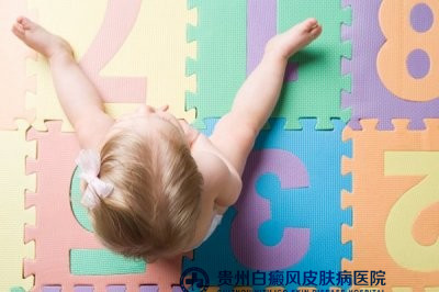 男性白癜风的患病原因是什么 男性白癜风的患病原因是什么