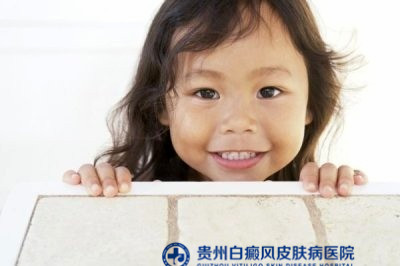 女性为什么会患上白癜风 女性为什么会患上白癜风