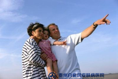 白癜风的护理措施是什么 白癜风的护理措施是什么
