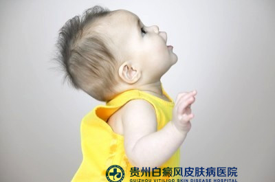 小儿白癜风家长要注意 小儿白癜风家长要注意