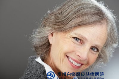 清镇白癜风专科哪里最好 清镇白癜风专科哪里最好
