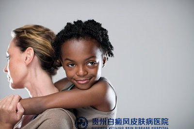 桂林哪家医院治疗白癜风最专业 桂林哪家医院治疗白癜风最专业