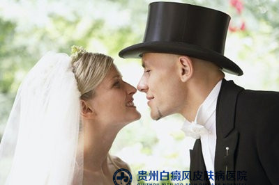 湘西治疗白癜风哪家好 湘西治疗白癜风哪家好