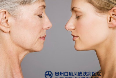 遵义白癜风医院最好的是哪家 遵义白癜风医院最好的是哪家