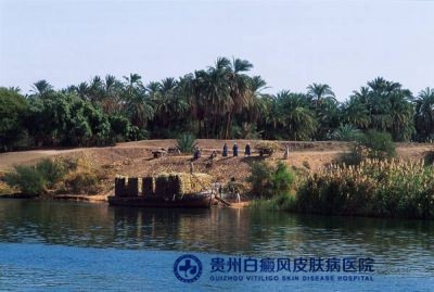 桂林治疗白癜风哪家好