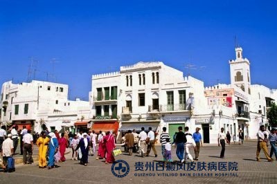 黔南治疗白癜风哪家好