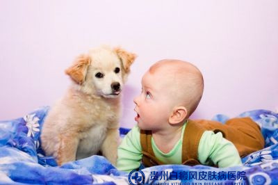 白癜风治疗用什么方法好