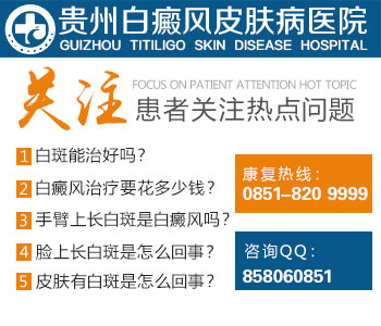 白癜风与白癣的鉴别方法