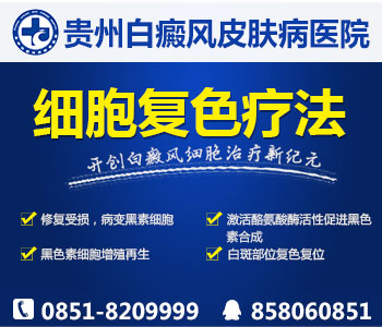 白癜风的预防