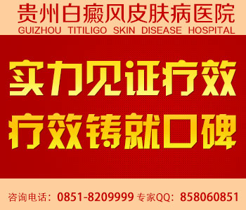 影响白癜风治疗效果的因素