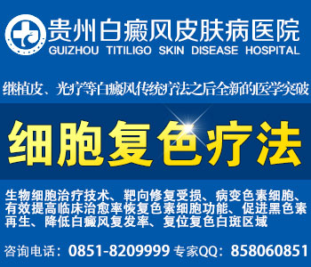中医和西医在白癜风方面有什么区别