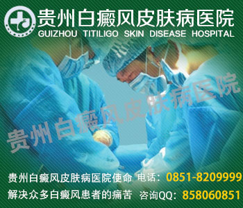 白癜风扩散的相关问题