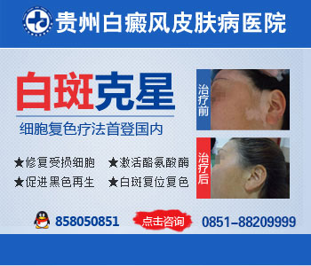 贵州省贵阳市白癜风专科医院