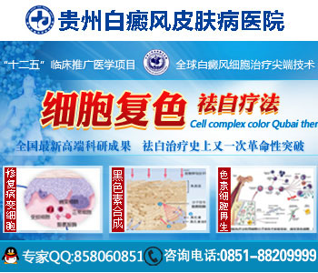 贵州哪治疗白癜风