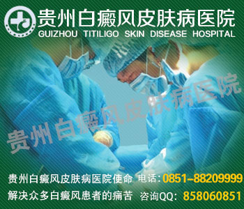 贵州到哪里白癜风专科好
